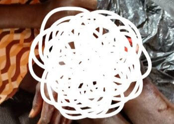 Siguiri : deux blessés dans une attaque à main armée à Doko