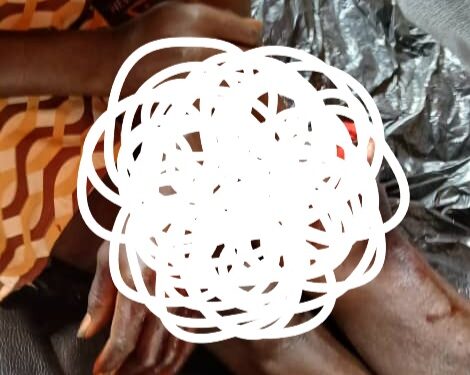 Siguiri : deux blessés dans une attaque à main armée à Doko