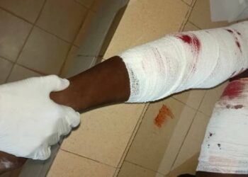 Siguiri : un orpailleur tué lors d&rsquo;une attaque à main armée vendredi soir