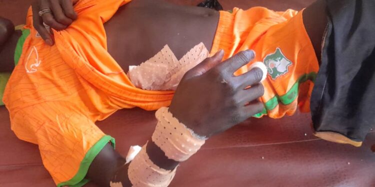 Siguiri : trois blessés dans trois attaques à mains armées en 48 heures