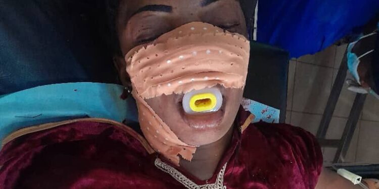 Siguiri/Lero : une femme sauvagement agressée dans un motel, l’auteur en cavale