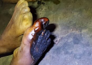 Macabre découverte à Matoto : un homme retrouvé mort dans un atelier de couture