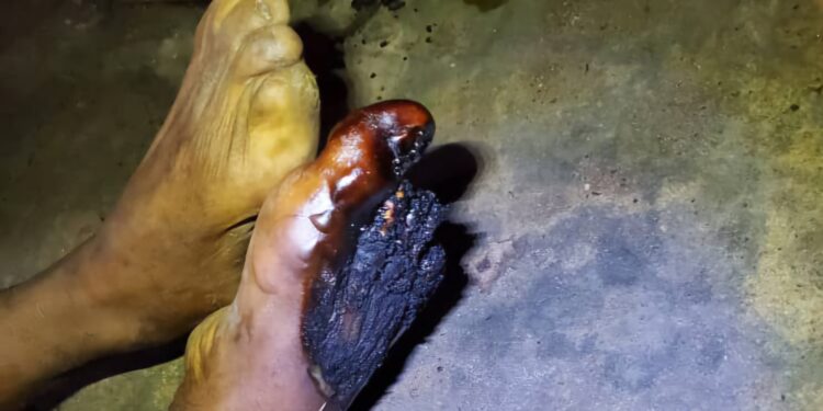 Macabre découverte à Matoto : un homme retrouvé mort dans un atelier de couture