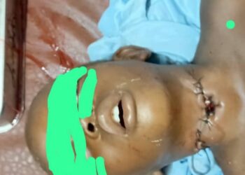 Siguiri: un acte chirurgical de fortune sauve de justesse un enfant égorgé