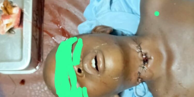 Siguiri: un acte chirurgical de fortune sauve de justesse un enfant égorgé