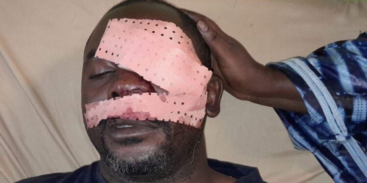 Conakry : le journaliste Daouda Bah transféré à Tunis pour des soins spécialisés