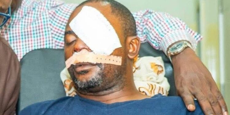 Tunis : le journaliste Daouda Bah exprime sa gratitude face à l’élan de solidarité après son agression