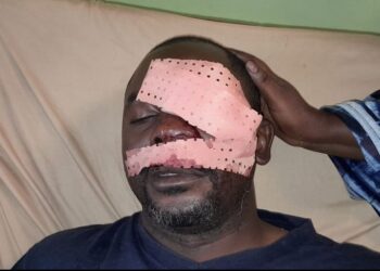 Conakry : le journaliste Daouda Bah agressé par des manifestants à Bomboly