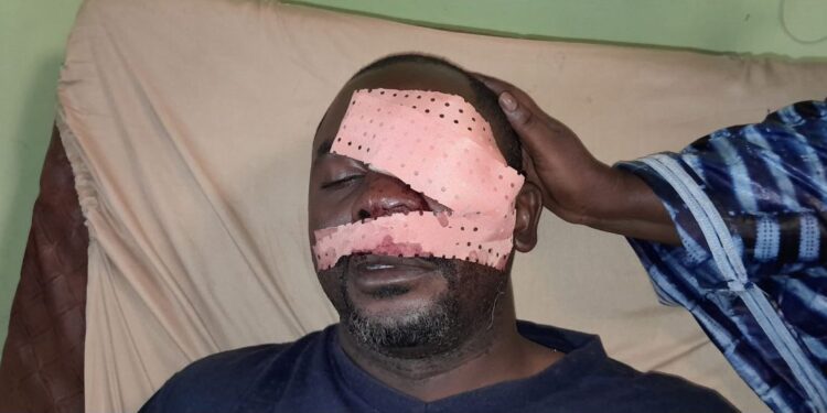 Conakry : le journaliste Daouda Bah agressé par des manifestants à Bomboly