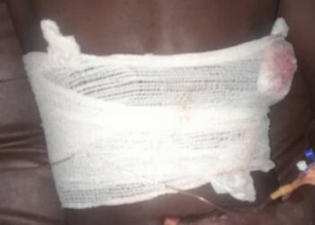 Siguiri: un jeune grièvement blessé dans une attaque, à main armée