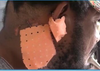 Insécurité à Conakry : le journaliste Kleit Nasser raconte sa nuit de cauchemar après l’hôpital 