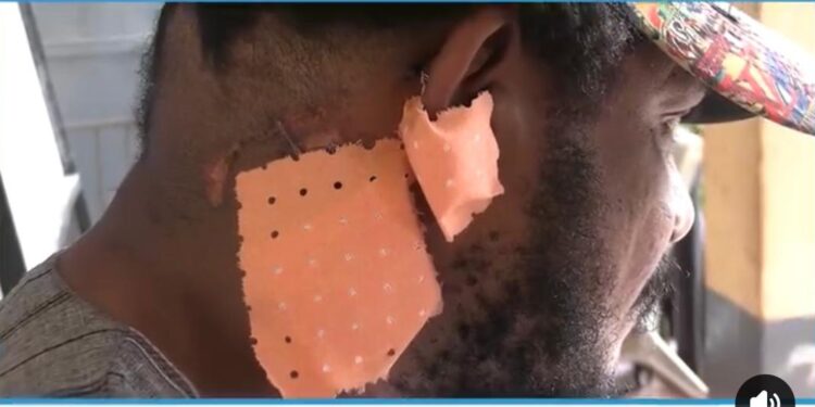 Insécurité à Conakry : le journaliste Kleit Nasser raconte sa nuit de cauchemar après l’hôpital 