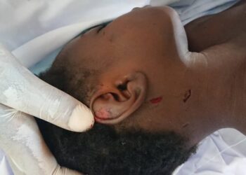 Siguiri: une fillette de 8 ans meurt suite aux coups de fouet présumés de sa tante