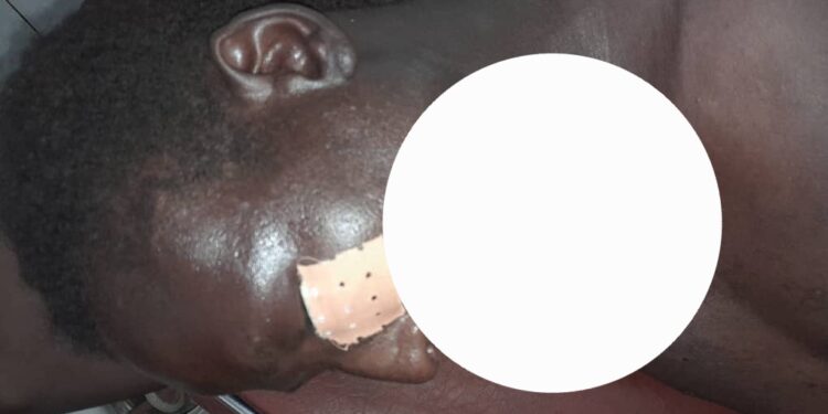 Siguiri: 9 blessés lors d’un accrochage entre deux camps pour le contrôle d’une mine artisanale