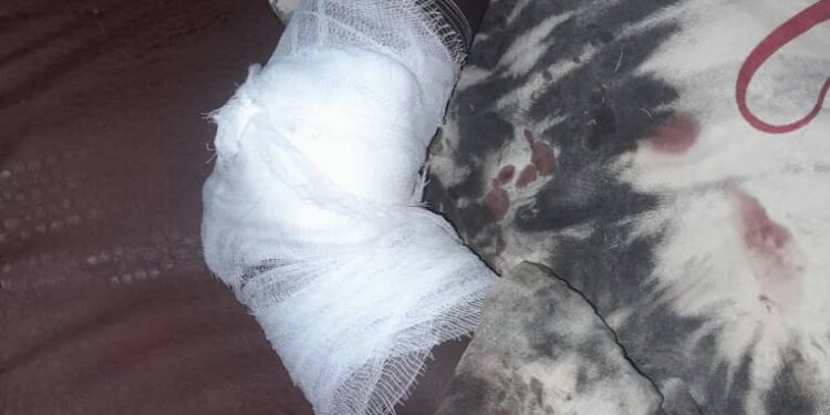 Siguiri : 1 mort et 4 blessés dans des affrontements à Weily Mining 