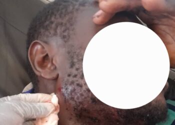 Siguiri: accrochage entre jeunes de Doko et de Tatakourou, 7 blessés dont 6 par balles (source hospitalière)