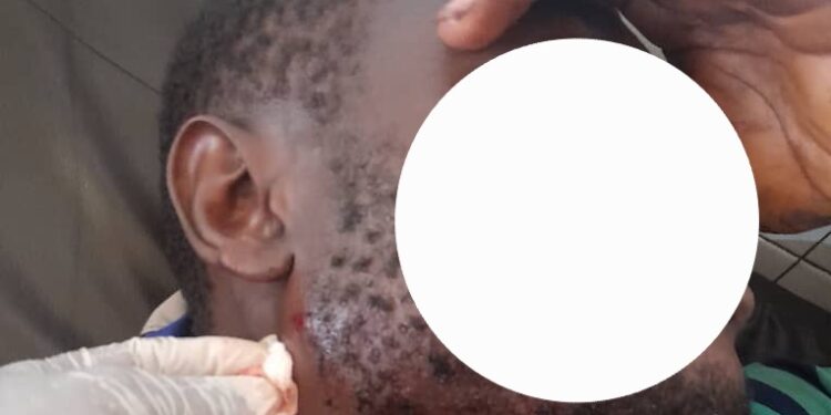 Siguiri: accrochage entre jeunes de Doko et de Tatakourou, 7 blessés dont 6 par balles (source hospitalière)