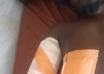 Siguiri/Gnagassola: sous l’effet de l’alcool, un féticheur tire sur son ami à Tondo