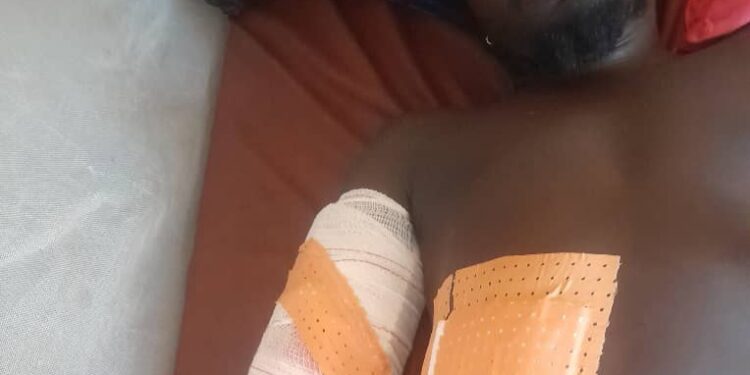 Siguiri/Gnagassola: sous l’effet de l’alcool, un féticheur tire sur son ami à Tondo