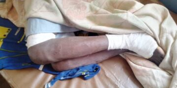 Tougué: un léopard sème la panique et blesse grièvement un citoyen