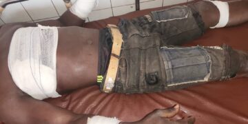 Siguiri : une attaque à main armée dans une mine d’or artisanale fait un blessé