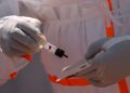 France : un premier cas d&rsquo;ébola confirmé