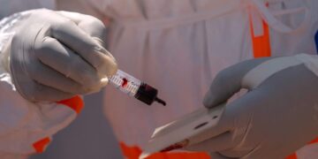 France : un premier cas d&rsquo;ébola confirmé