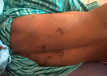 Siguiri : le corps d&rsquo;un adolescent de 17 ans exhumé sur fond de soupçons de lynchage familial