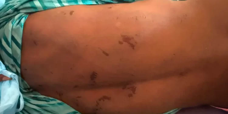 Siguiri : le corps d&rsquo;un adolescent de 17 ans exhumé sur fond de soupçons de lynchage familial