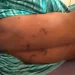 Siguiri : le corps d&rsquo;un adolescent de 17 ans exhumé sur fond de soupçons de lynchage familial